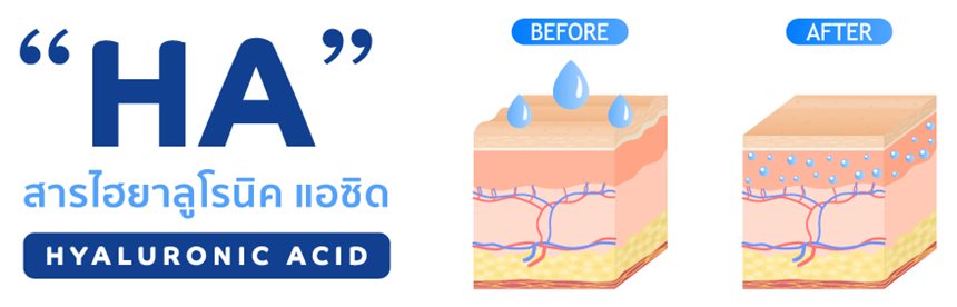 RC-Filler ฟิลเลอร์ HA ไฮยาลูโรนิคแอซิด