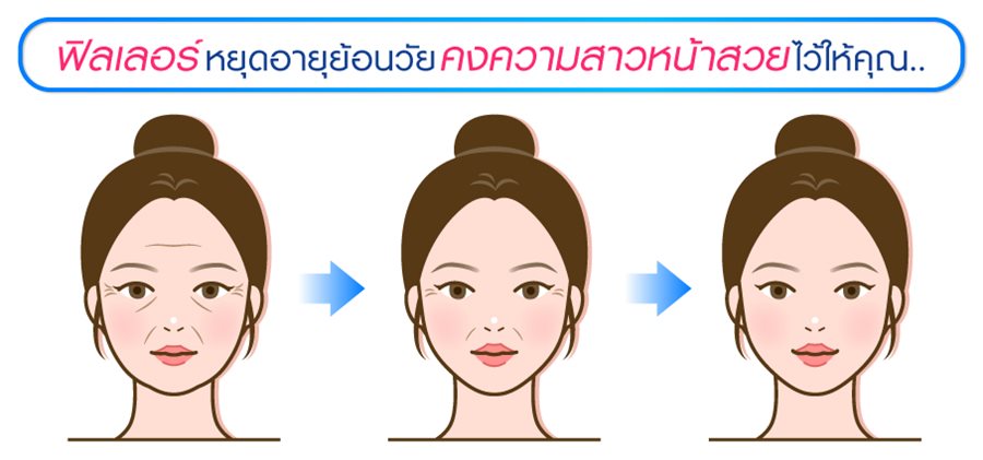 RC-Filler ฟิลเลอร์หยุดอายุย้อนวัยที่ราชเทวีคลินิก