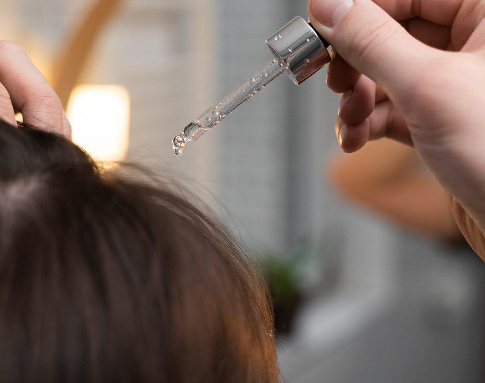 Article Dandruff รังแคบนหนังศีรษะ