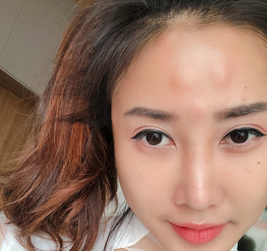 Review-Nana-Skin-Booster-chiangmai-5.jpg Review-Nana-Skin-Booster-chiangmai-5.jpg