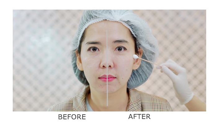 Review Sudsapda รีวิวหน้าเหนื่อยดูโทรมไม่สดใส